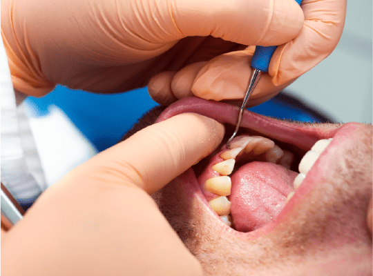 Periodoncia